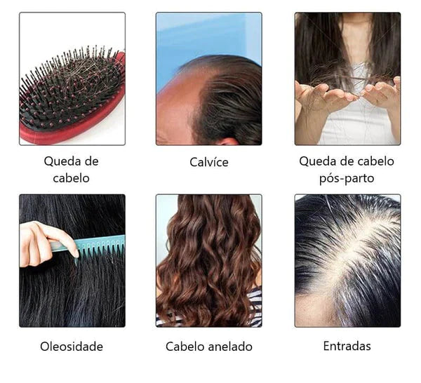 Escova a Laser – Terapia para Crescimento Capilar HairRise Saude & Beleza (Escova de cabelo 2) Dm Stores