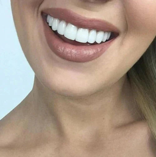 Facetas Odontológicas Removíveis Saude & Beleza (Facetas Odontológicas 1) Dm Stores